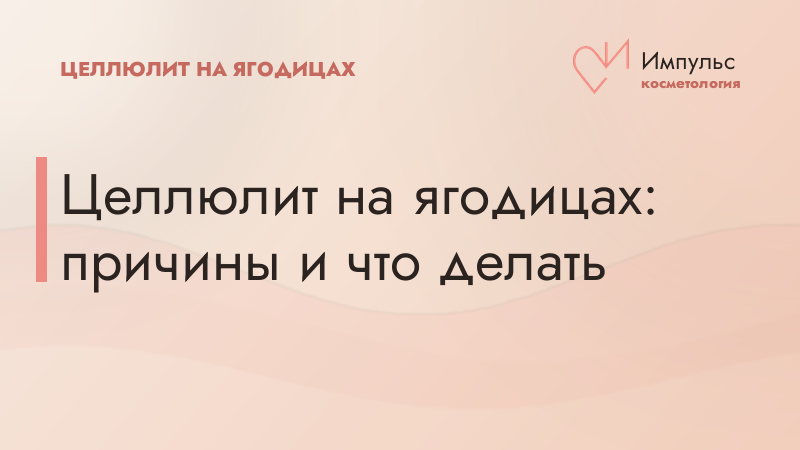 Целлюлит на ягодицах: причины и что делать